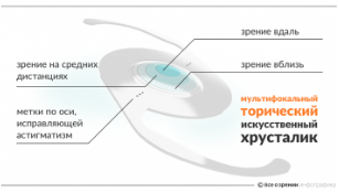 торический искусственный хрусталик