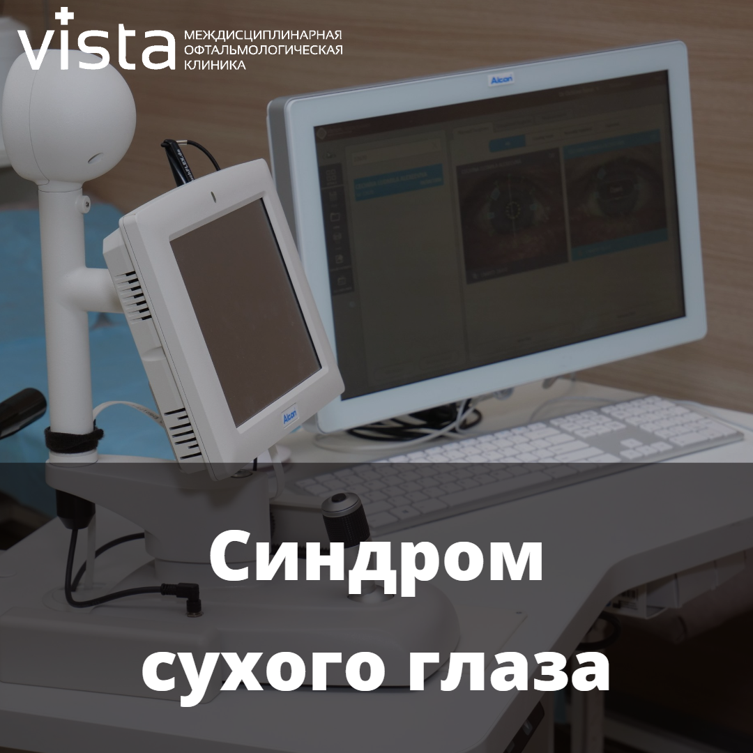 Синдром сухого глаза (ССГ)