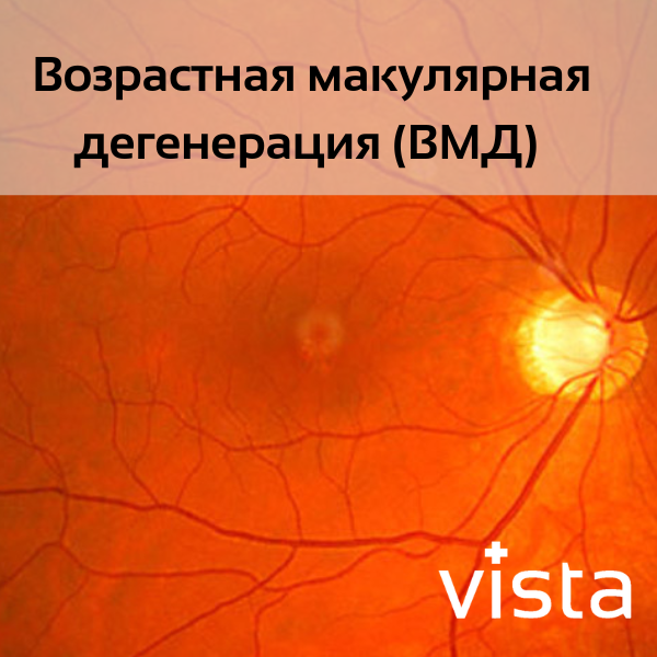 ВМД: виды и лечение