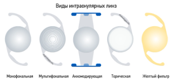 интраокулярные линзы