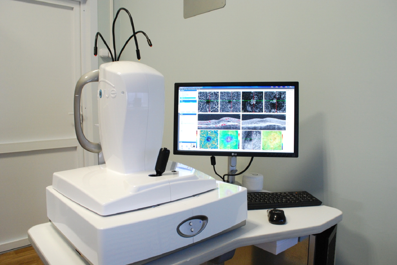Использование томографа позволяет неинвазивно исследовать сосудистое русло сетчатки 